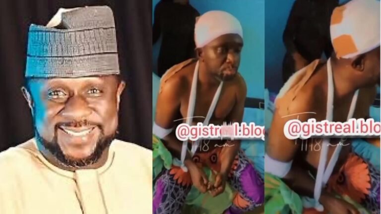 Actor Lekan Olatunji receives prayers from fans as he sustains severe injuries from an accident (Video)